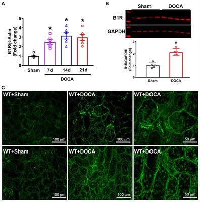 Kinin B1 Receptor Mediates Renal Injury and Remodeling in Hypertension